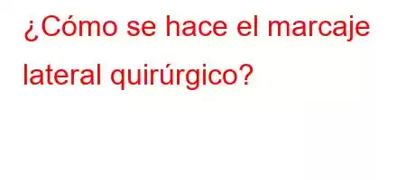 ¿Cómo se hace el marcaje lateral quirúrgico?