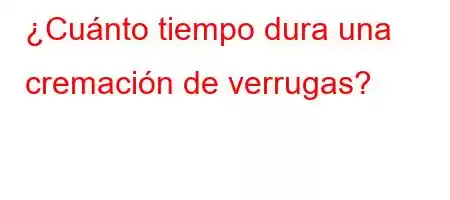 ¿Cuánto tiempo dura una cremación de verrugas?