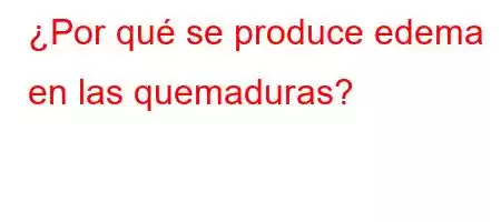 ¿Por qué se produce edema en las quemaduras?