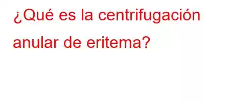 ¿Qué es la centrifugación anular de eritema?