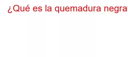 ¿Qué es la quemadura negra?