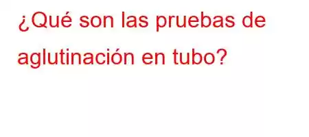 ¿Qué son las pruebas de aglutinación en tubo